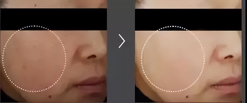 韩国东星小黑瓶祛斑霜，​韩国东星制药60年口碑企业出品！