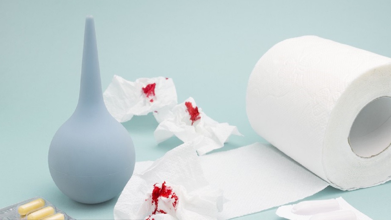 24岁女生肛裂正常吗,16岁女孩经常肛裂怎么治疗