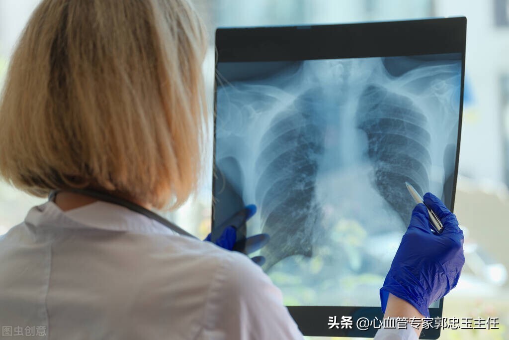 彩超心脏检查能查到心包疾病吗,心脏彩超检查哪些疾病