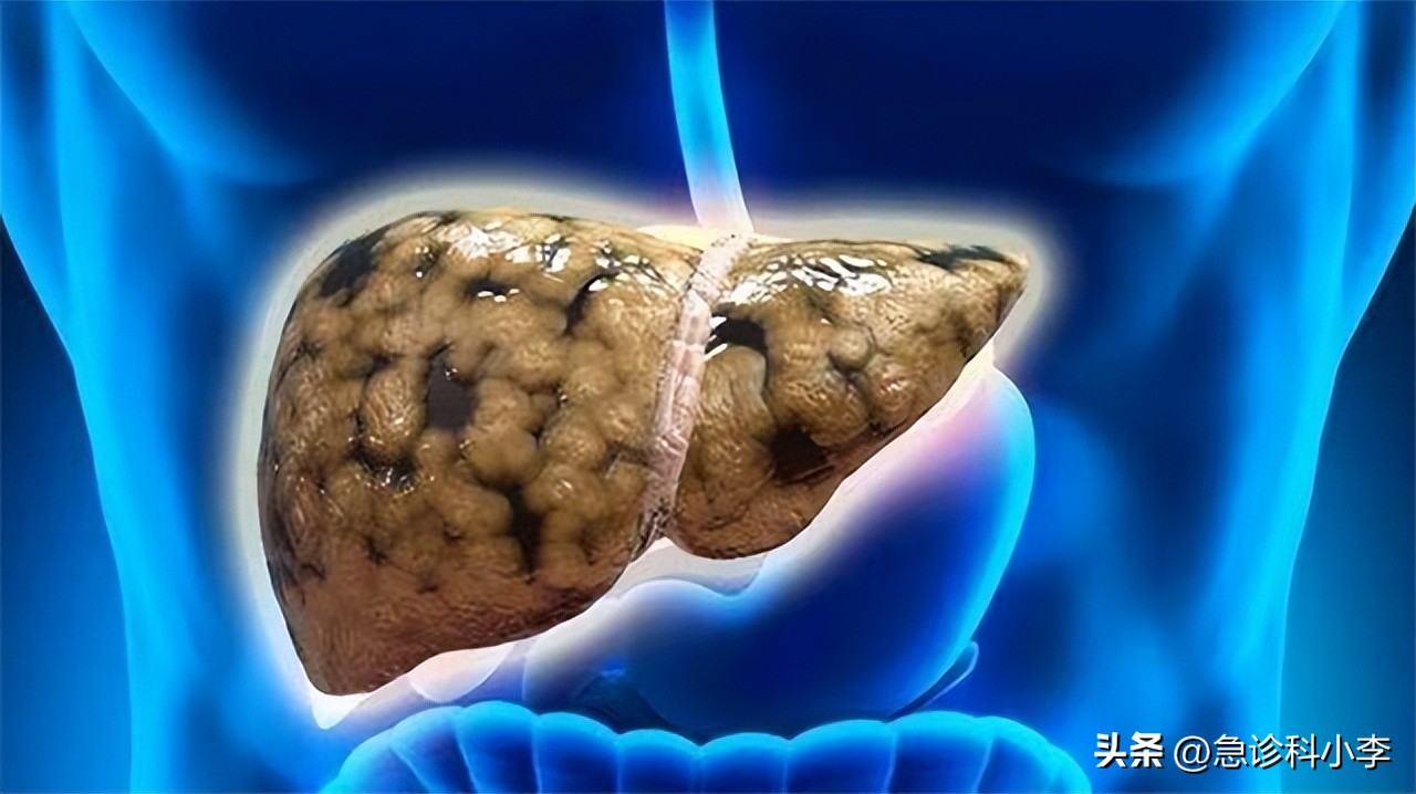 酒瘾烟瘾和毒瘾,酒瘾烟瘾哪个危害更大