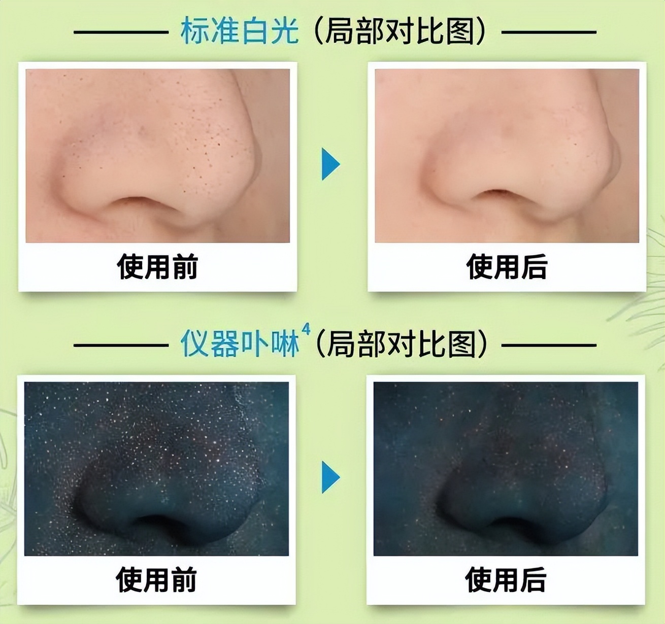 科颜氏白泥面膜清洁去黑头125ml,科颜氏白泥面膜真的能去黑头吗