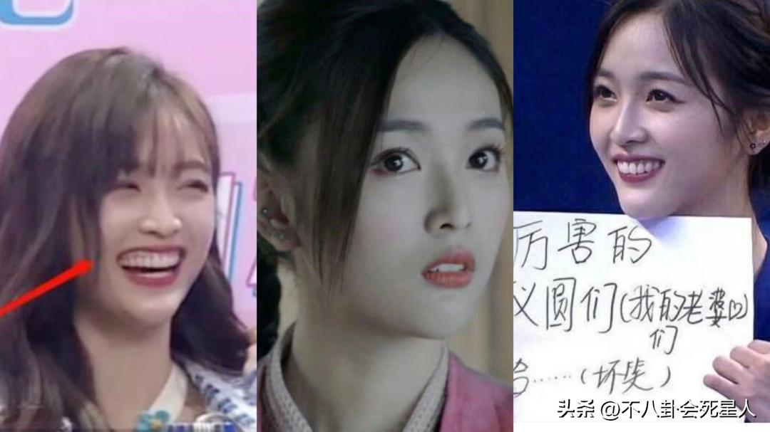 烤瓷牙有多恐怖,烤瓷牙害我一生