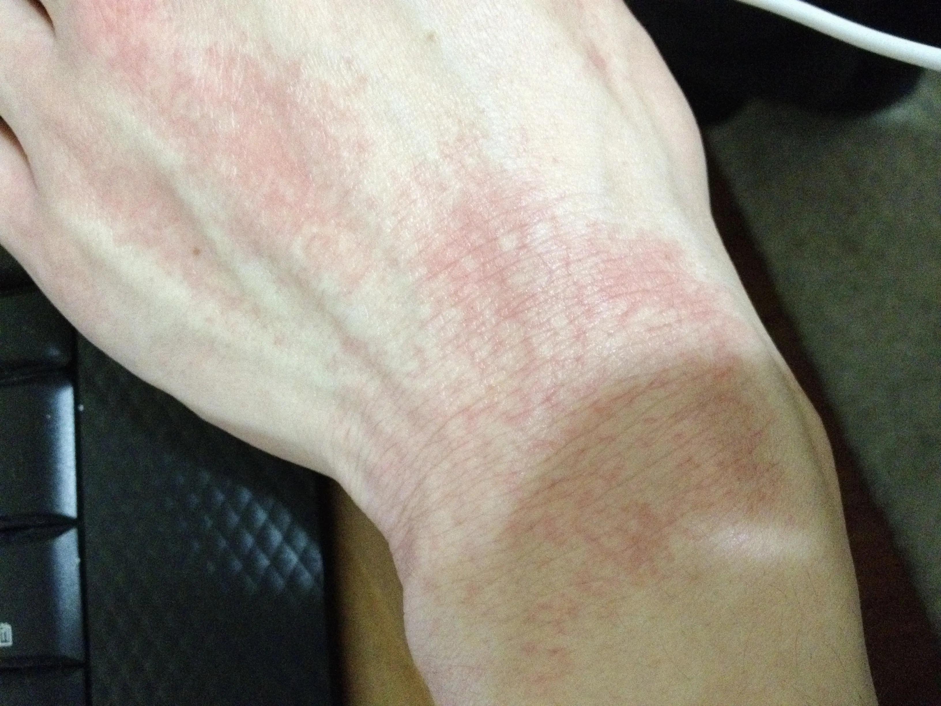 手沾到山药汁痒痒怎么办,山药痒手怎么办迅速止痒