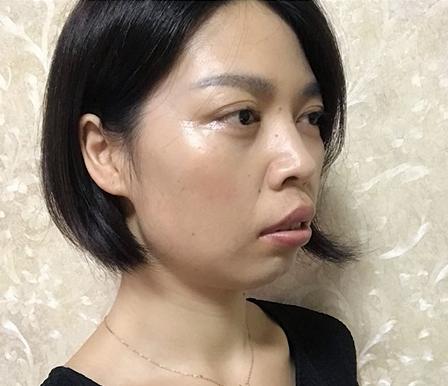 显老的罪魁祸首是什么,显老除了法令纹还有什么纹