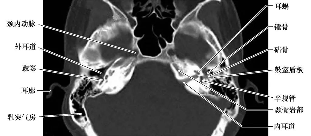 耳部解剖结构和生理功能,耳部解剖笔记