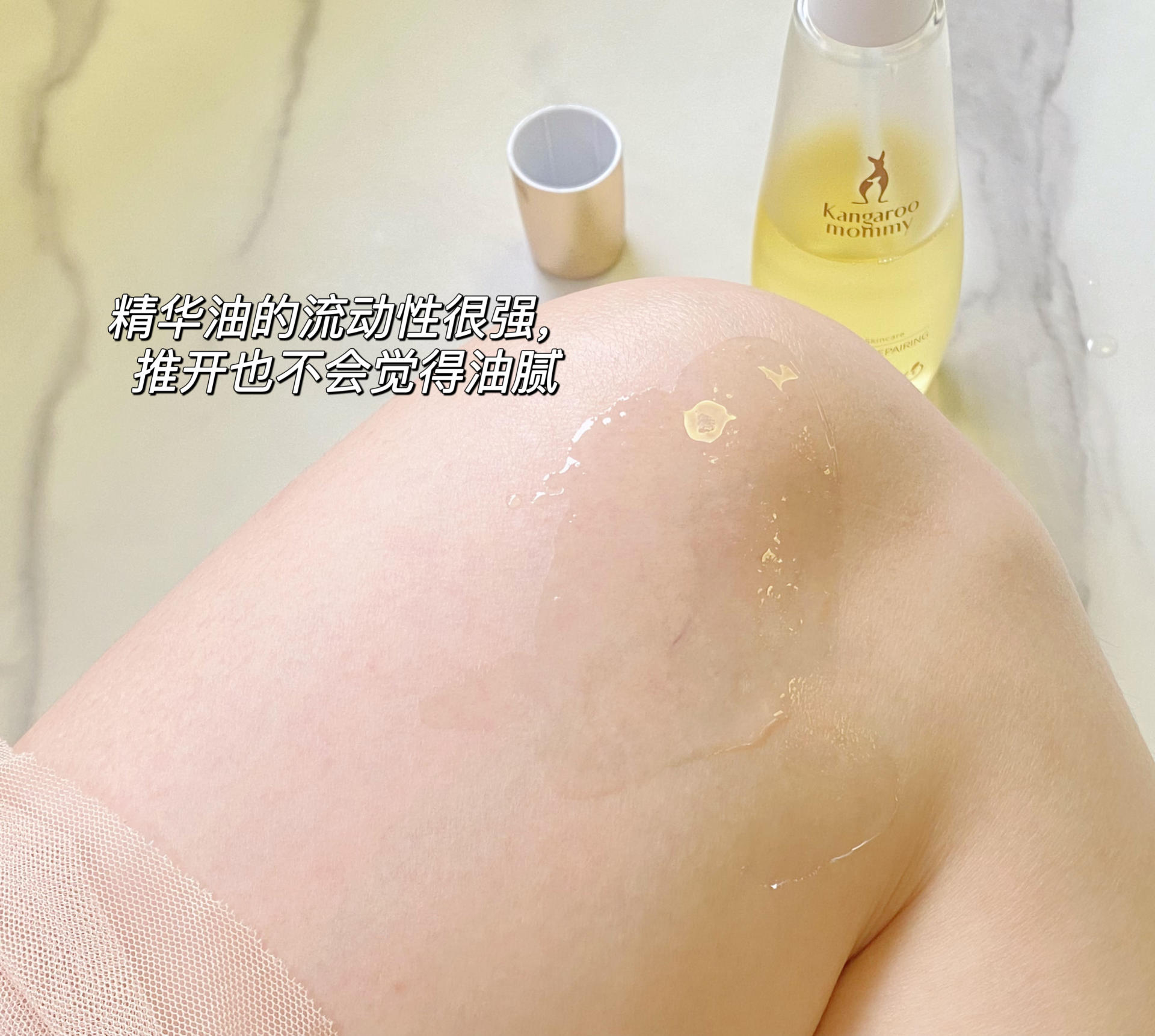 肥胖纹目前最好的去除办法,淡化肥胖纹修复肥胖纹