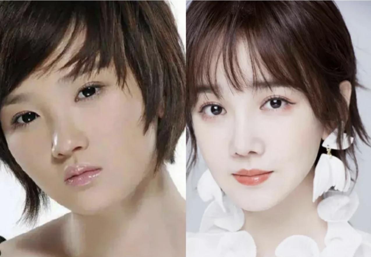 哪些明星整容后遗症越来越严重,整容明星后遗症对比图片