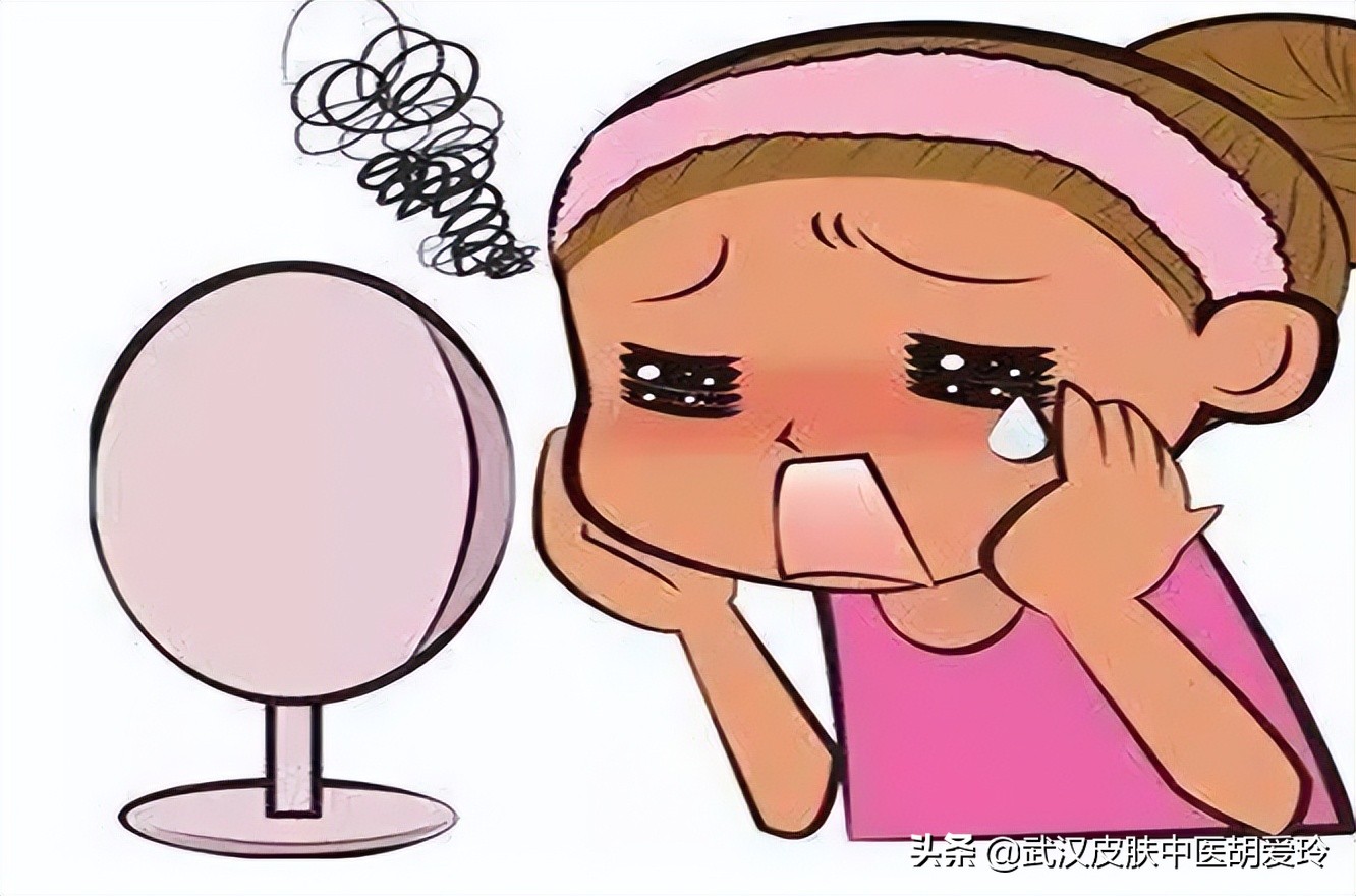 脸上的斑可以吃中药调理去掉吗,脸上红圆斑怎么治疗