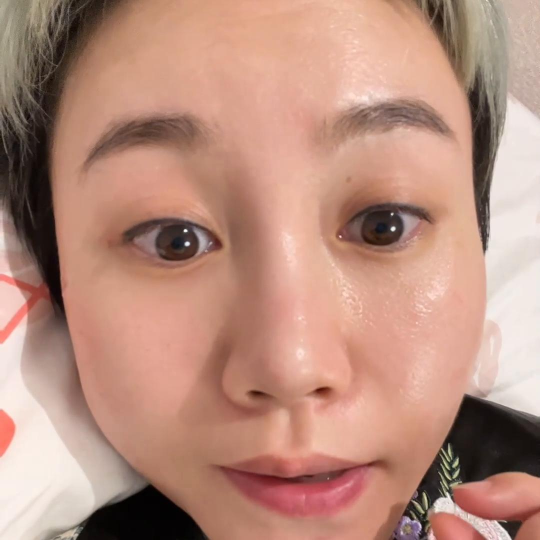 30岁容易长痘用什么洗面奶,30岁脸上突然长痘怎么回事