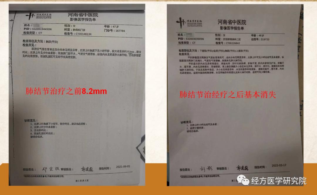 甲状腺结节乳腺增生经方案例,王付教授谈结节