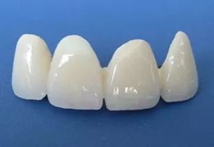 国产氧化锆烤瓷牙价格,二氧化锆烤瓷牙国产和爱尔创区别