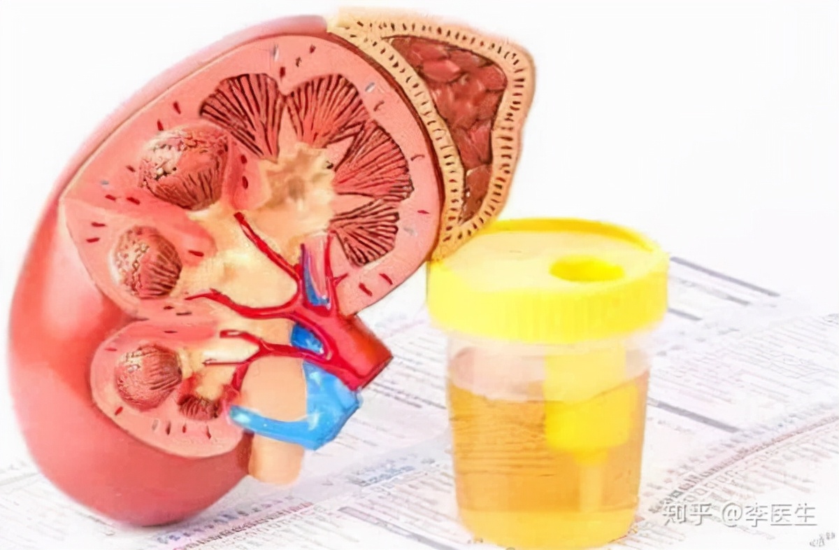 肾病喝草药能降低尿蛋白吗,吃补肾中药能治尿蛋白吗