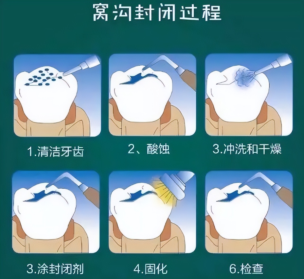 @所有家长:十个孩子九个蛀牙?只要做到这两点就可以避免