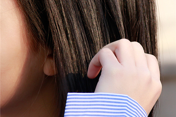 头皮屑大块严重是什么原因,头皮屑大块大块的怎么回事