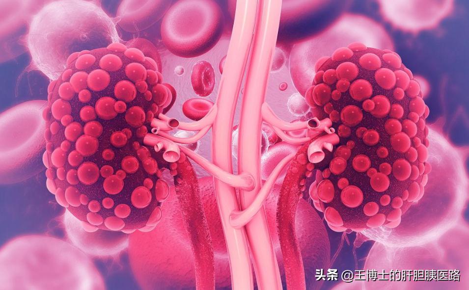 非奈利酮最新消息,非奈利酮治疗糖尿病肾病效果