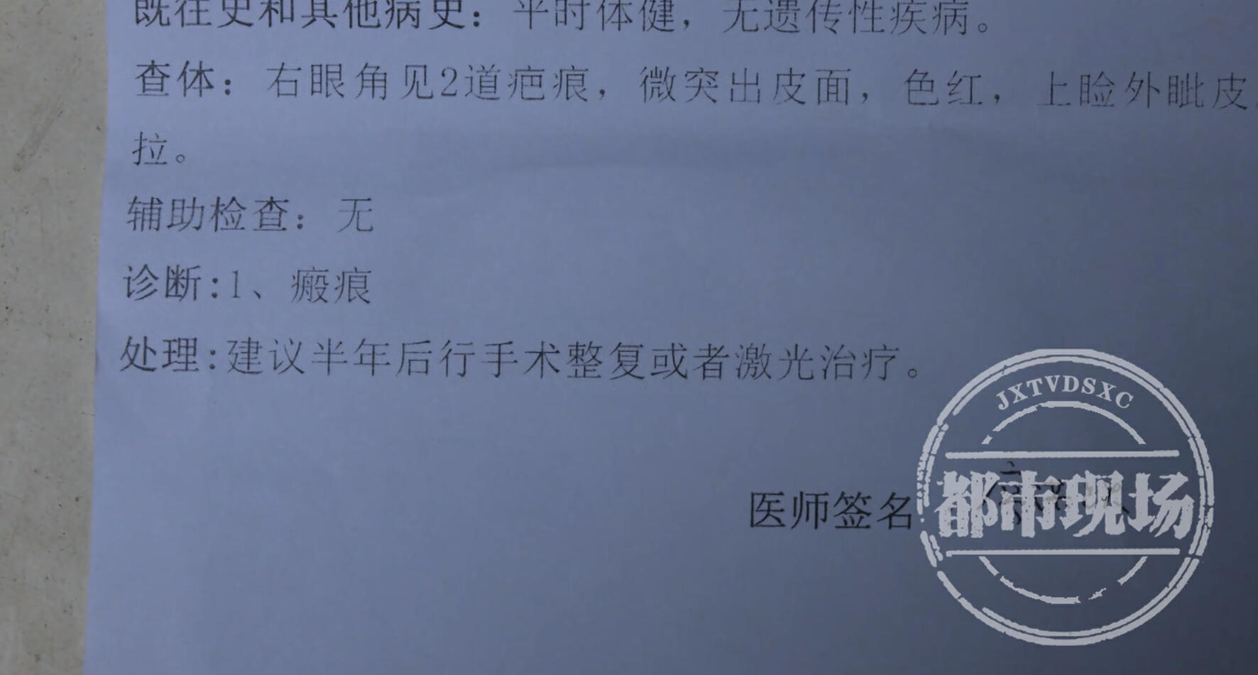 玩密室逃脱摔伤脚踝落下,男子玩密室逃脱摔成残疾