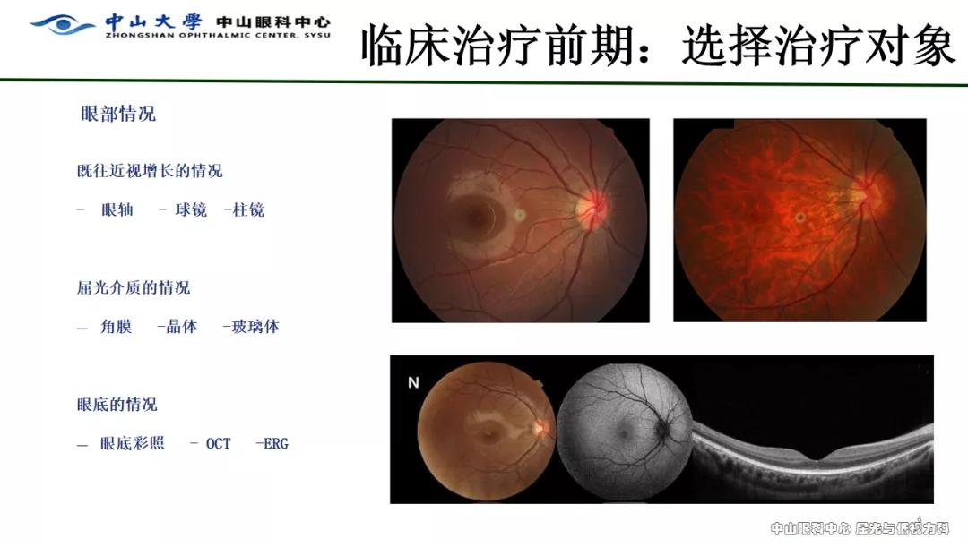 红光治疗预防近视多久做一次,红光干预预防近视
