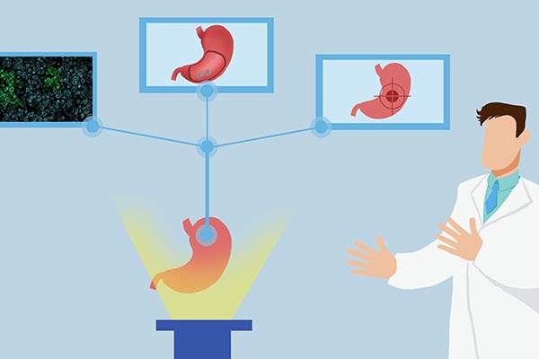 做胃镜怎样反应是胃癌,胃镜就能诊断胃早期癌吗