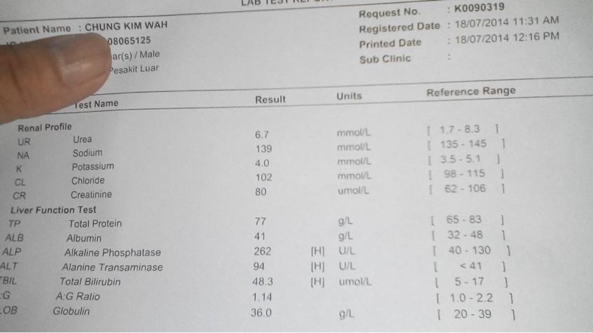 胆红素高用什么药可以很快降下来,直接胆红素和总胆红素高吃什么药
