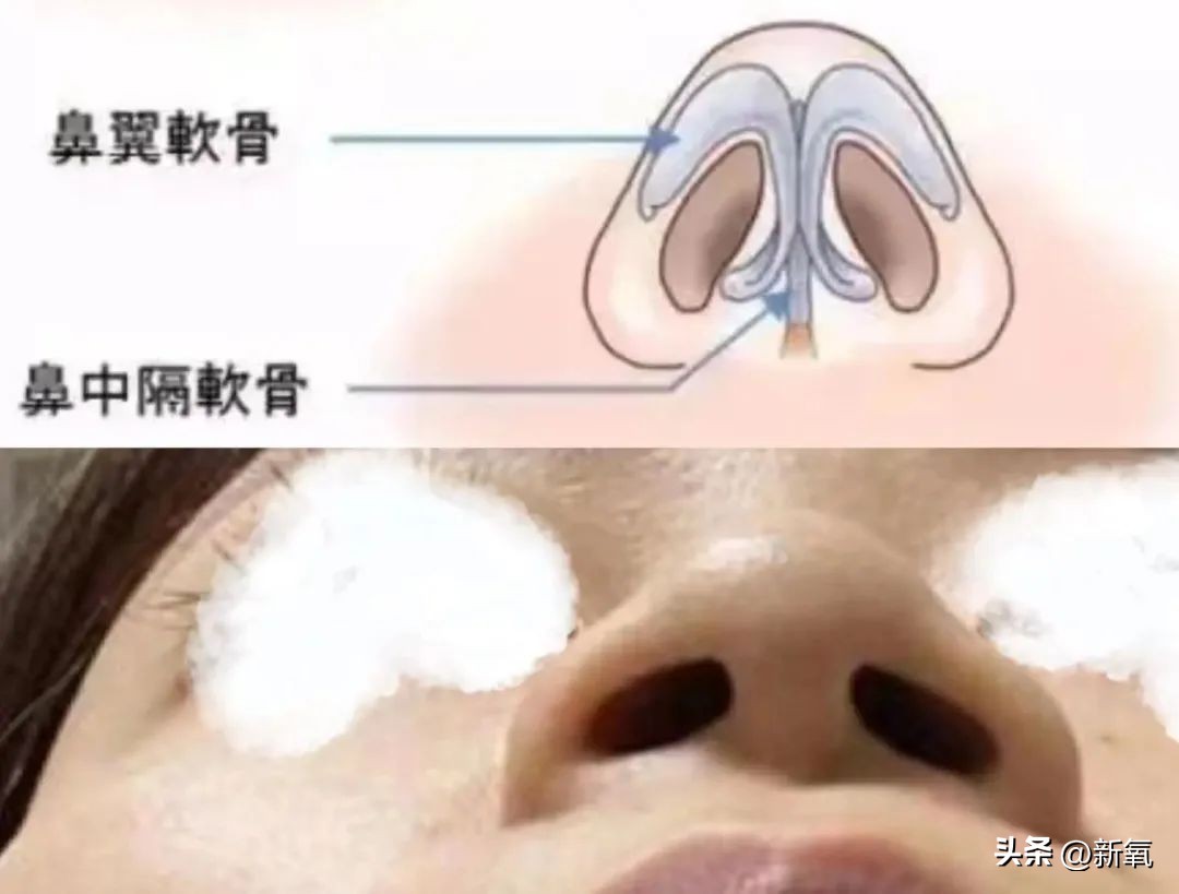 改一点赢很大？她整完鼻子直接美成断代神颜…