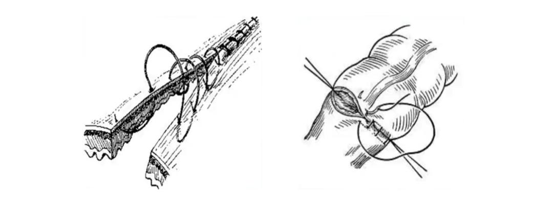 外科缝合技巧你熟练吗,外科缝合术的操作步骤