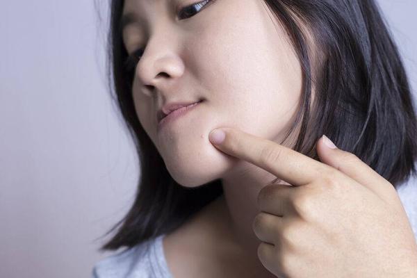 脸上长痘痘怎么办最简单的方法,脸上长痘痘这几招轻松解决