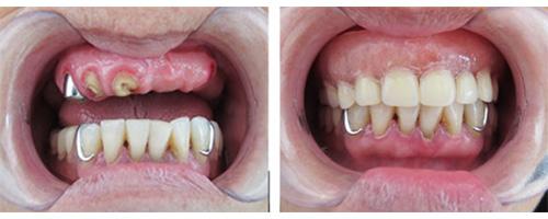 康贝种植牙,康贝口腔医生吴兴