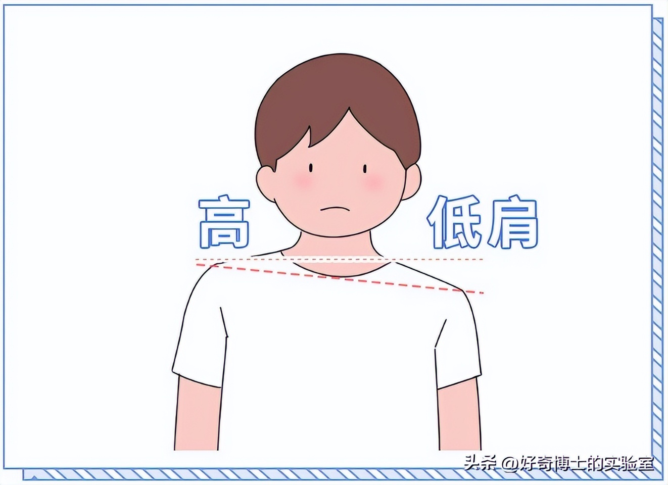 哪些姿势对腰部有损伤,哪种姿势对腰的伤害大