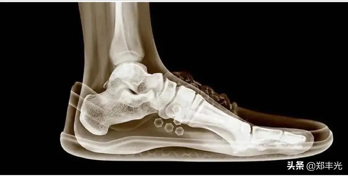 你穿对码数了吗？鞋子不舒服，很可能是选错了码数