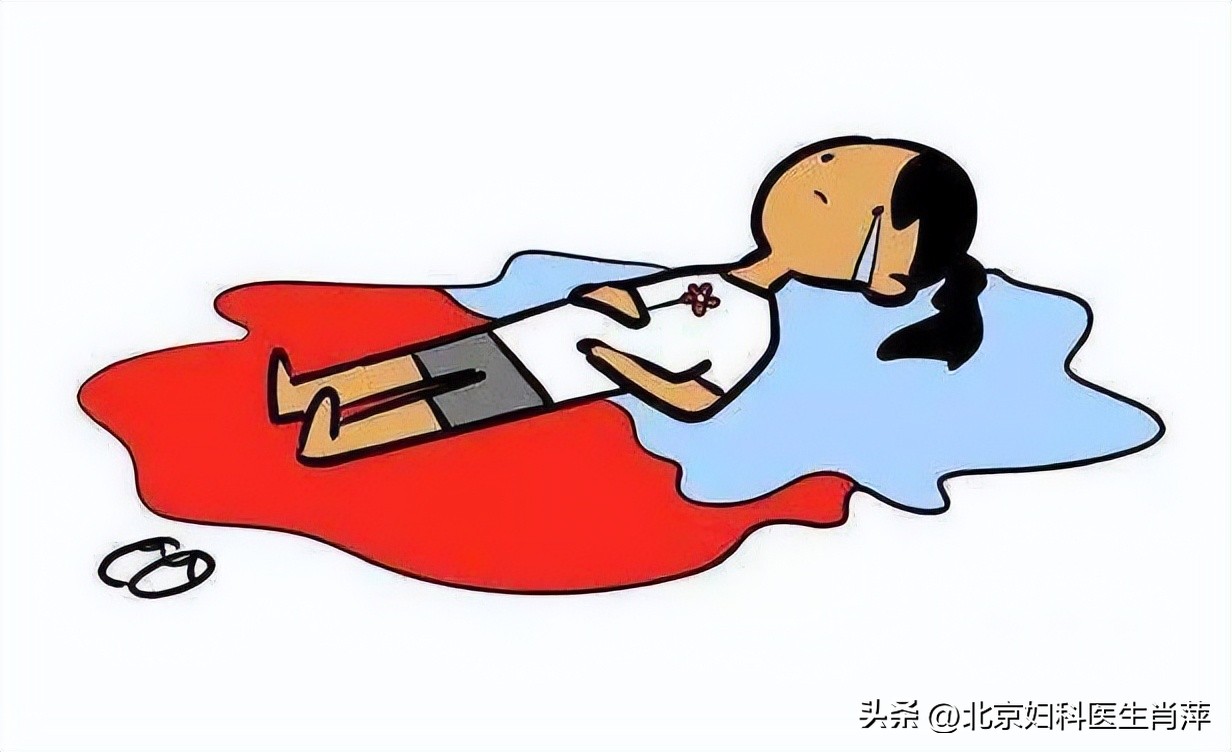 腺肌症月经量大可以服止血药吗,腺肌症导致月经过多该怎么止血