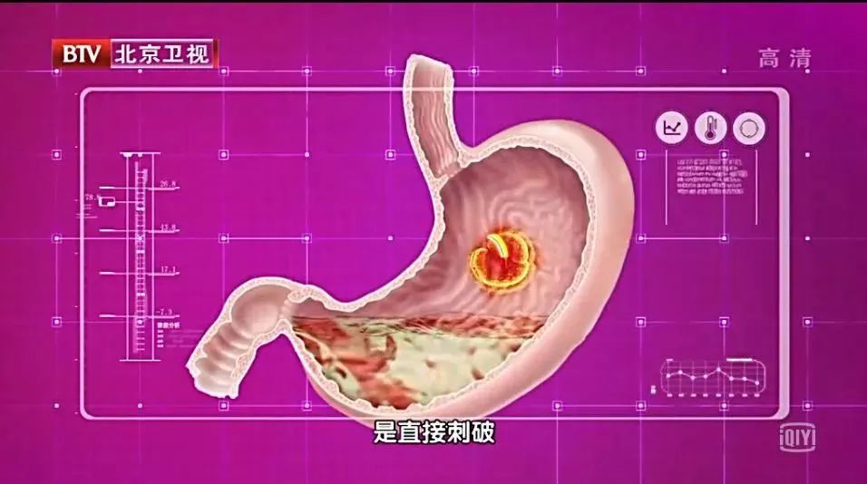 慢性肝损伤怎么引起消化系统疾病,疾病都是不良习惯造成的吗