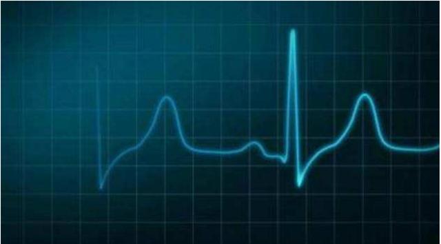 心率越慢寿命越长是真的吗,心率快与心率慢对人的寿命影响