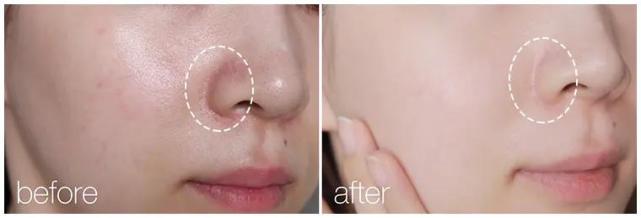 逛超市时候这三种水果最好不要买,日本口碑最好的万能霜