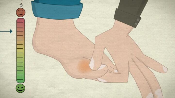 脚趾骨折断端稍分离移位,判断脚趾是骨折还是损伤的方法