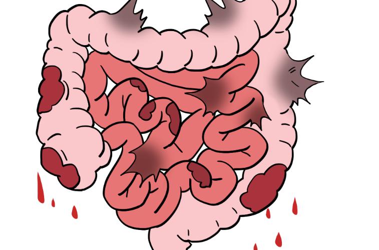 被吹上天的这六种保健品，坑人还伤害身体，千万别再上当了