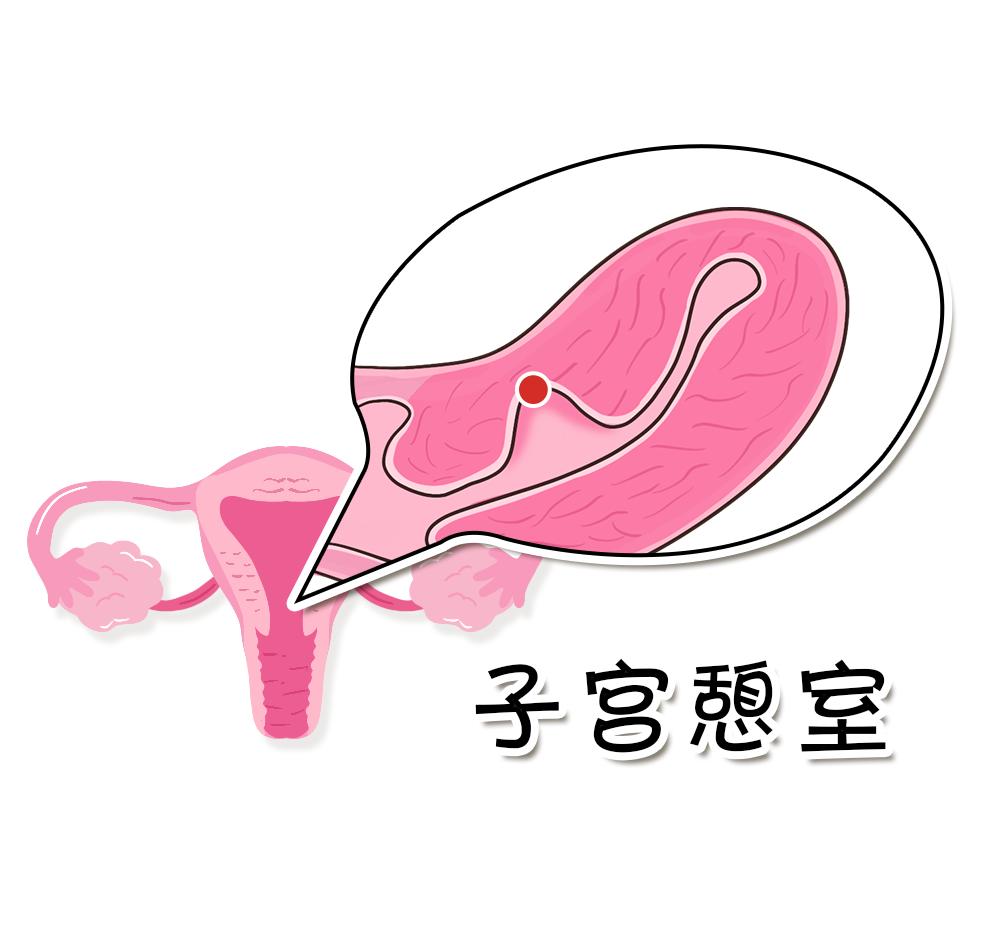 月经长达一个多月,月经十天了还不干净一用力就出血