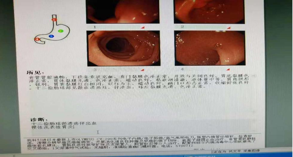 再三提醒：十二指肠溃疡时，身体会发出这种求救信号，别太晚知道