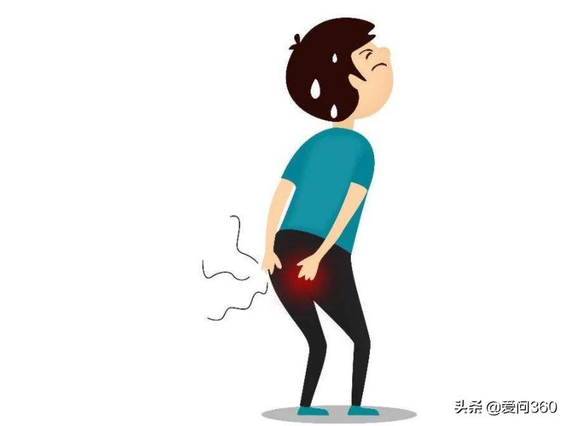 痔疮的预防方法主要是什么,关于痔疮的9个防治常识