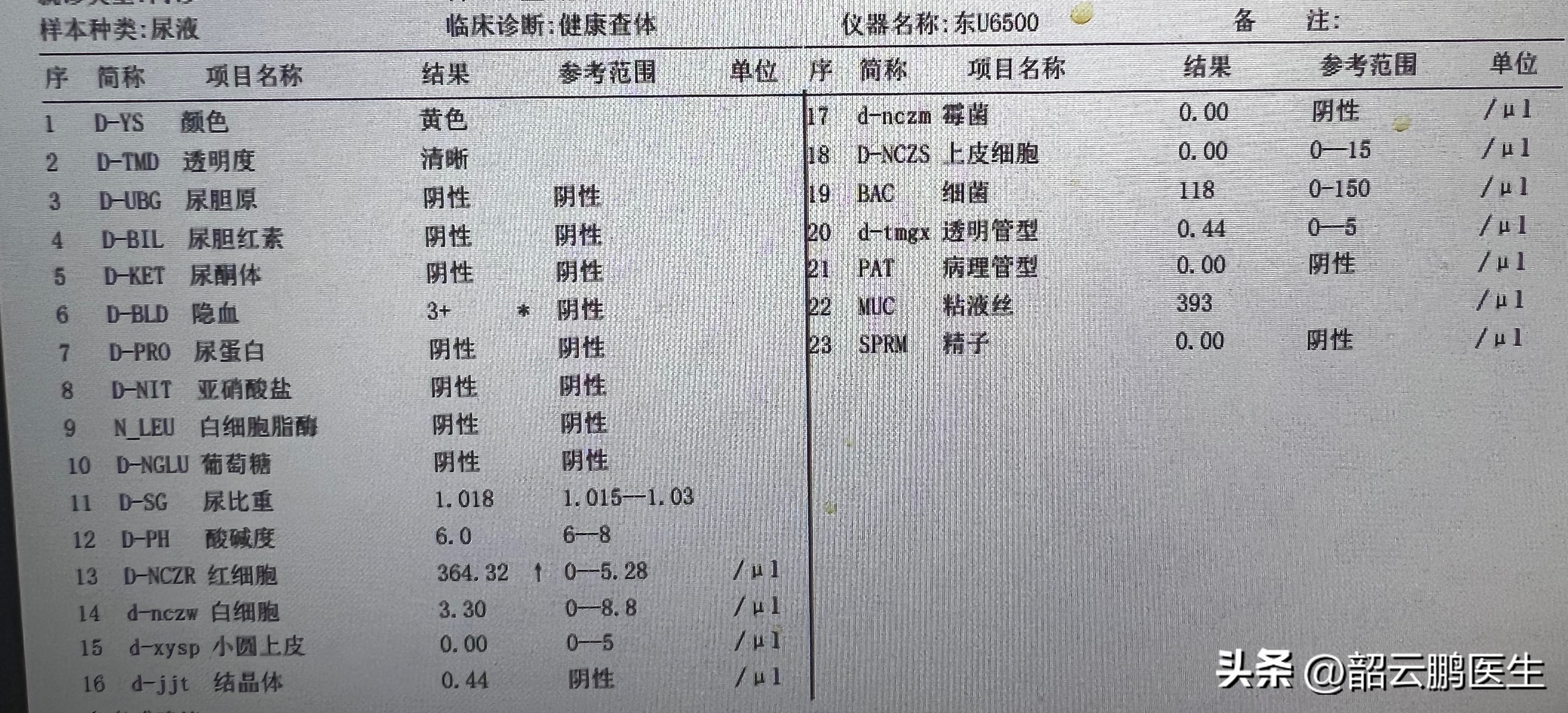 尿常规可以发现哪些异常,尿常规有两个加号代表什么