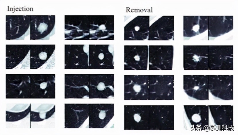 CT-GAN：利用深度学习恶意篡改三维医学图像