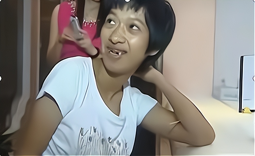 广东罕见双性人,广东出现罕见双性人