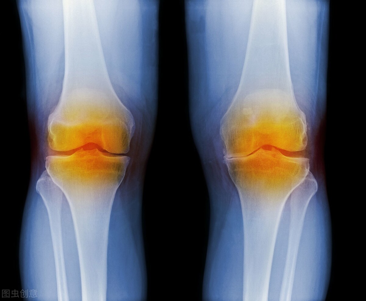 手关节退变性骨关节炎的治疗方法,如何治疗退行性关节病