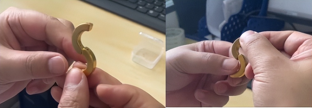 “小磁环”巧解大难题西安交大一附院应用S形磁环治疗直肠狭窄