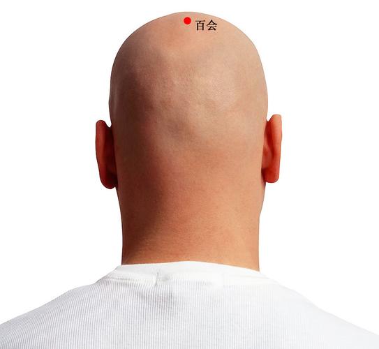 中医扎针治疗偏头痛,夹脊脉冲电针疗法