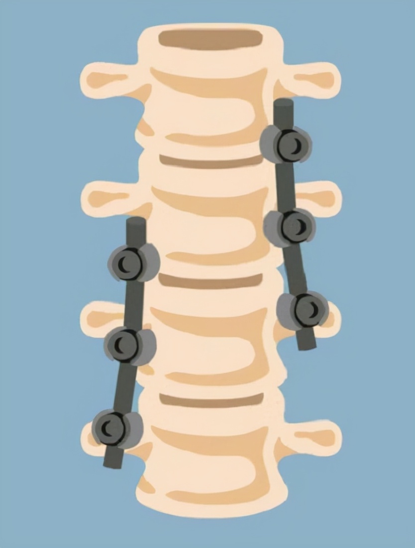 女腰痛要警惕四种原因,男人右边腰痛什么原因