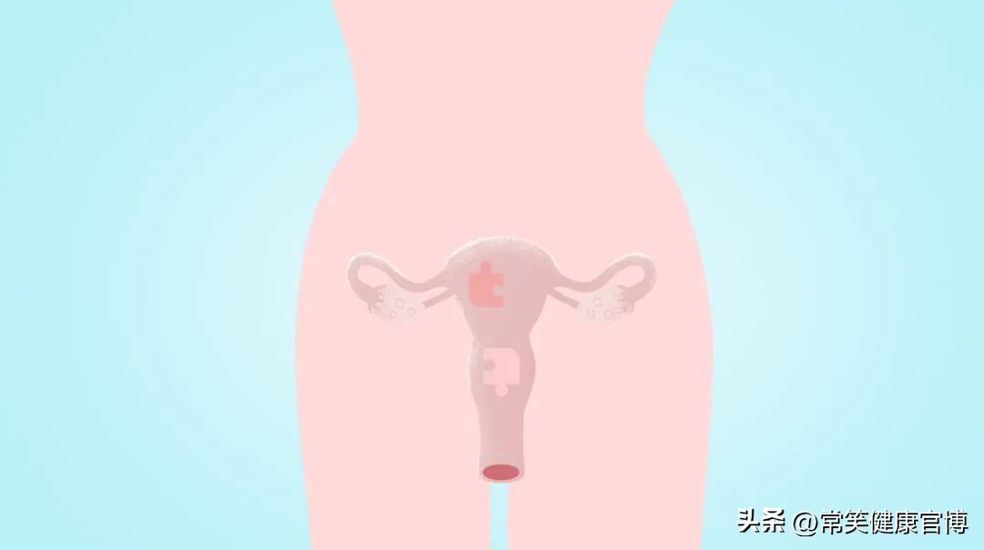 绒毛膜癌的症状和治疗方法,绒毛膜癌首选的治疗方法