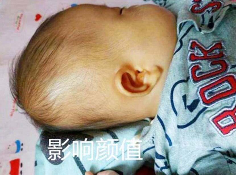 未满月婴儿护理,新生儿照顾有禁忌