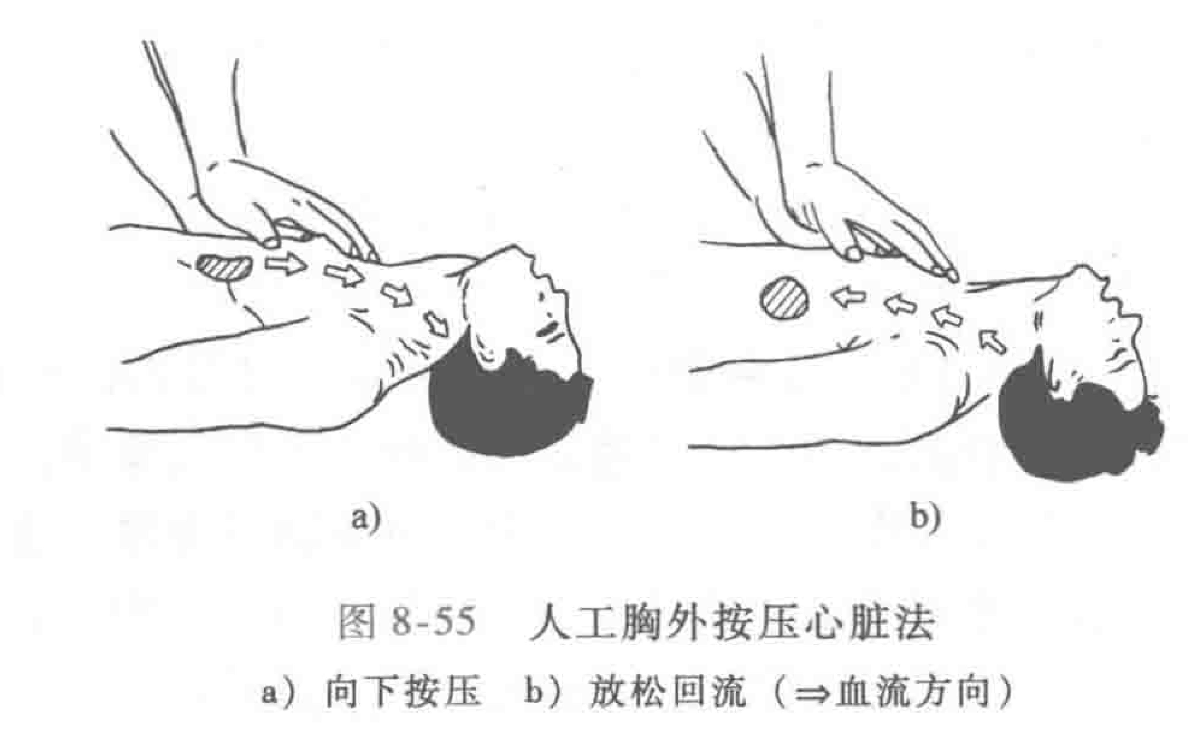 触电的急救处理有什么方法,触电的急救处理