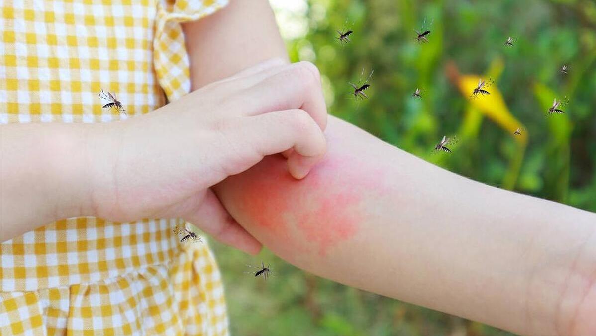 我是a血型为什么蚊子总是咬我,同样血型蚊子为什么只咬我