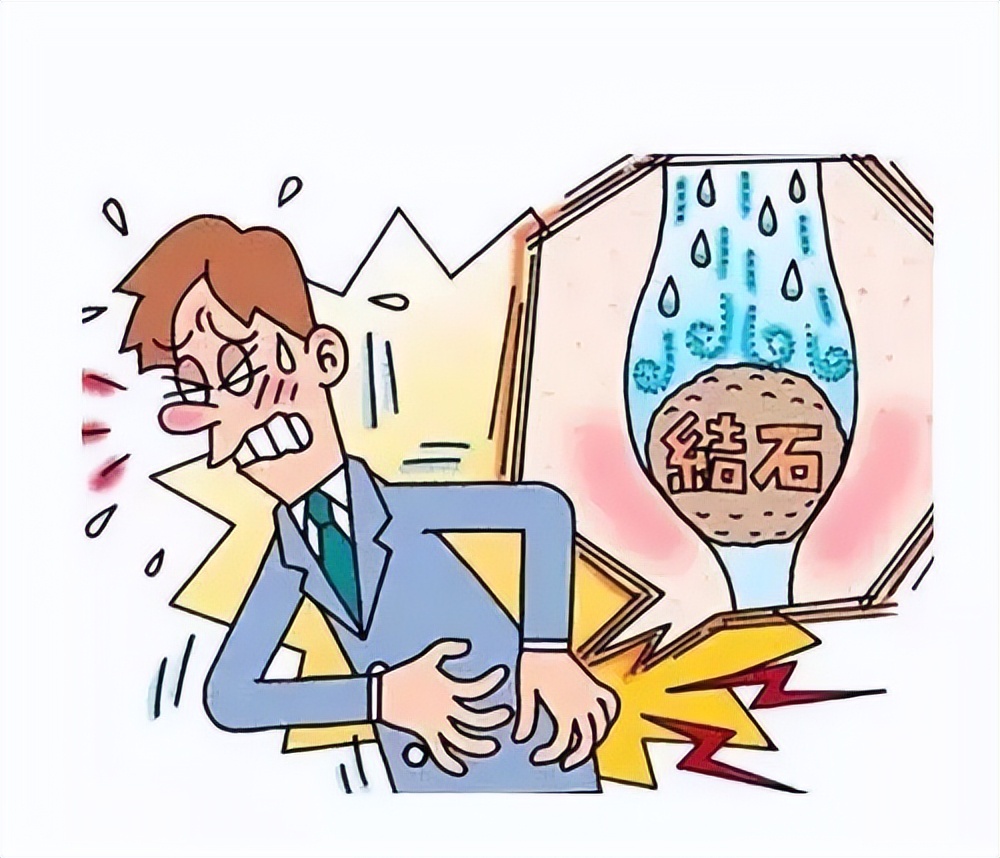 输尿管结石什么情况下需要碎石,输尿管结石的最佳治疗方法有哪些